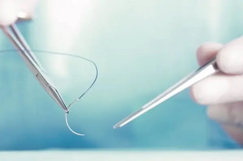 جراحی عمومی